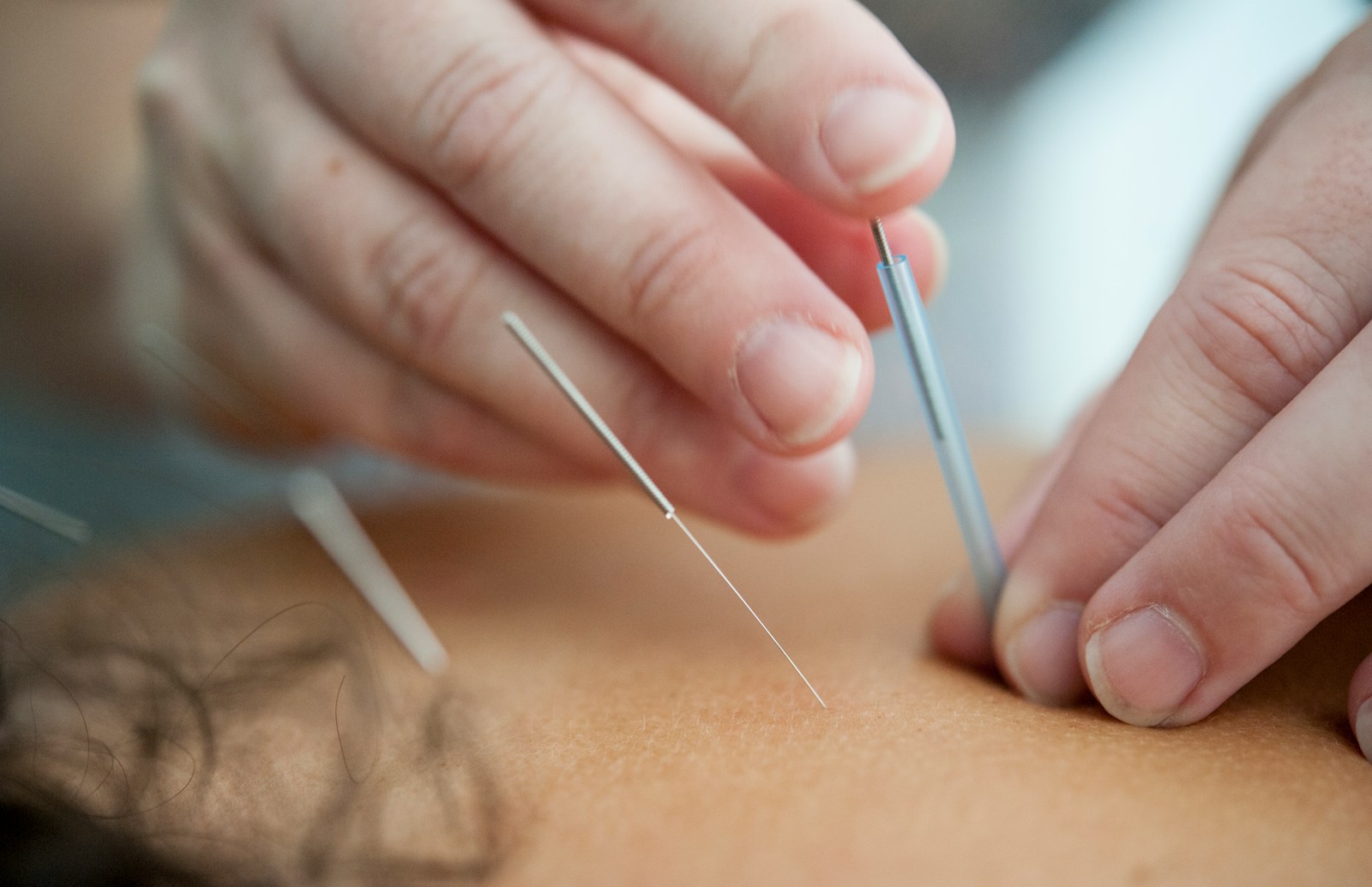 Prescritores de fórmulas chinesas e acupuntura, Mivegan, fitoterapia chinesa, prescritores medicina chinesa, tratamentos naturais.